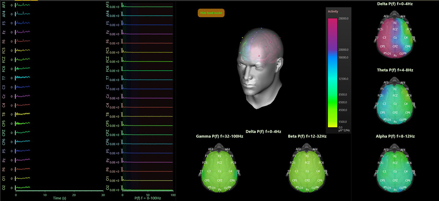 EEG Data Visualization